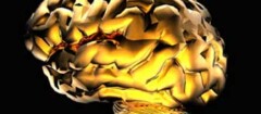 neurologia-tatuape-1408045033